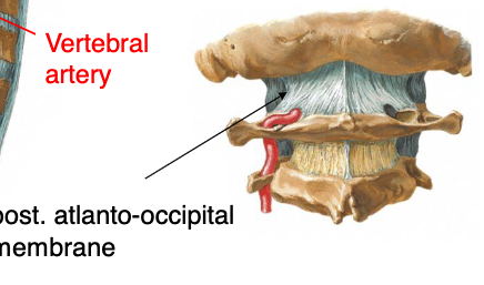 <p>posterior atlanto-occipital membrane</p>