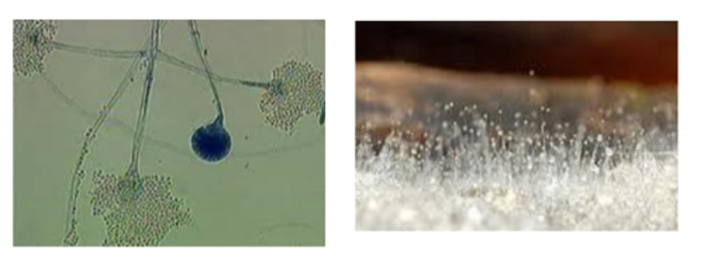 <p>· Common contaminant</p><p>· Lid lifters</p><p>· Maturity in about 4 days; growth inhibited by cycloheximide</p><p>o Rapid growers</p><p>· Cottony or moist surface, becomes grey; reverse white</p><p>· Rhizoids absent</p><p>haircut: Don King the boxing promotor</p>