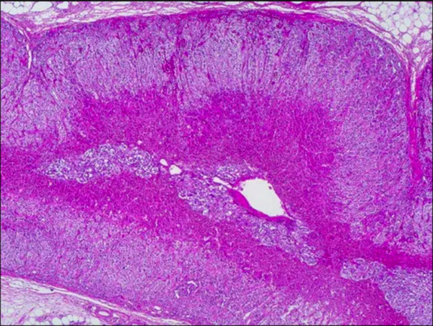 <p>entire gland. comprised of glandular tissue (outer layers) and nervous tissue (deepest portion).</p>