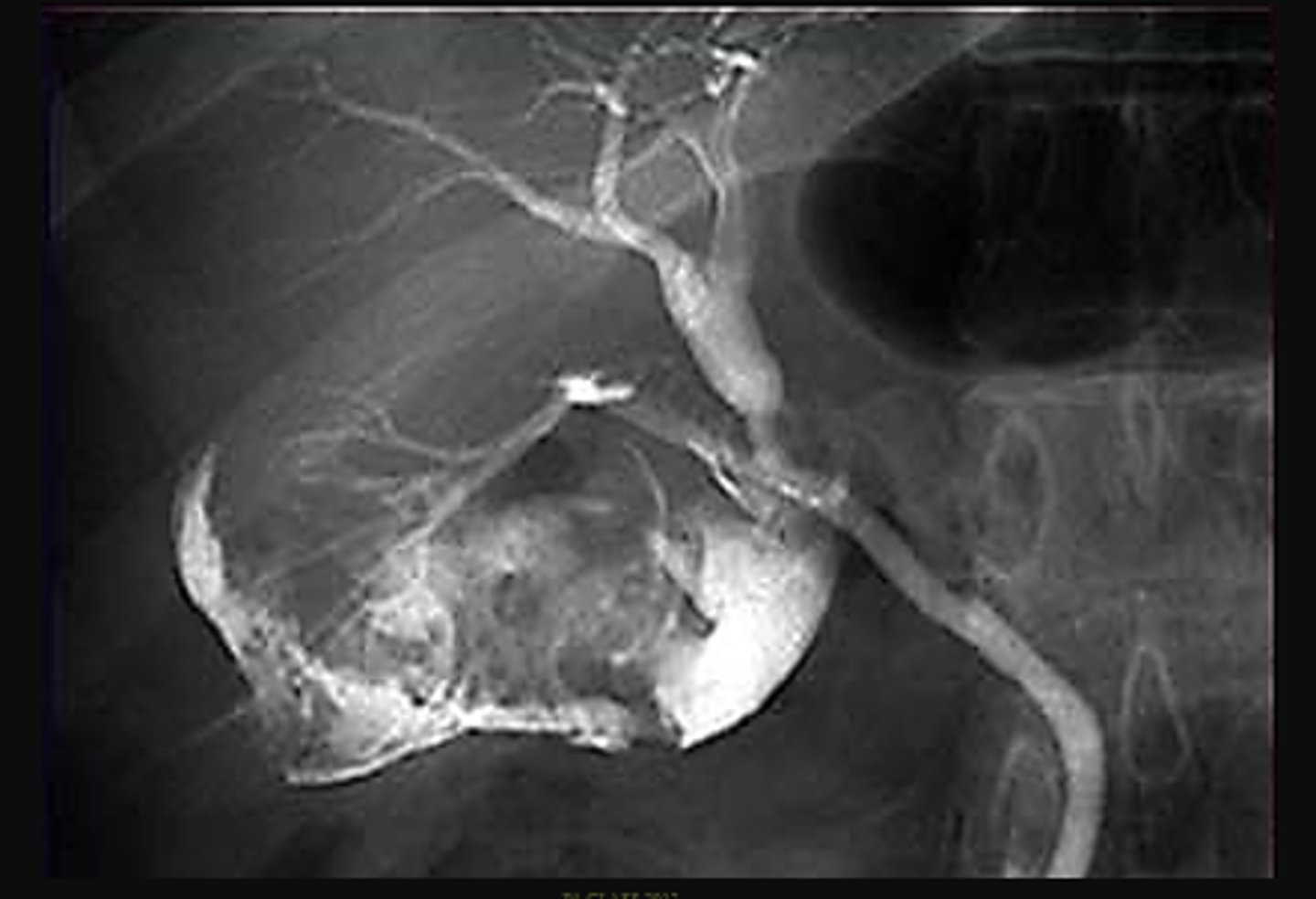 <p>medio de contraste, colorante de contraste, líquido de contraste</p>