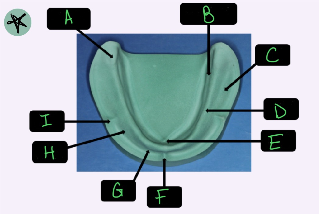 <p>What structure is labeled H?</p>