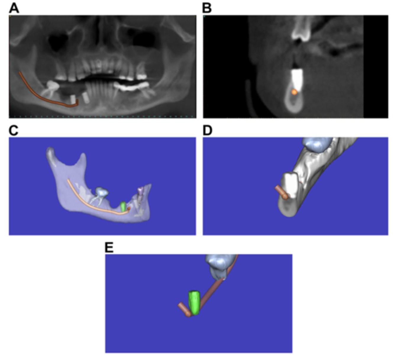 <p>Obtain a CT scan to determine true relationship.</p>