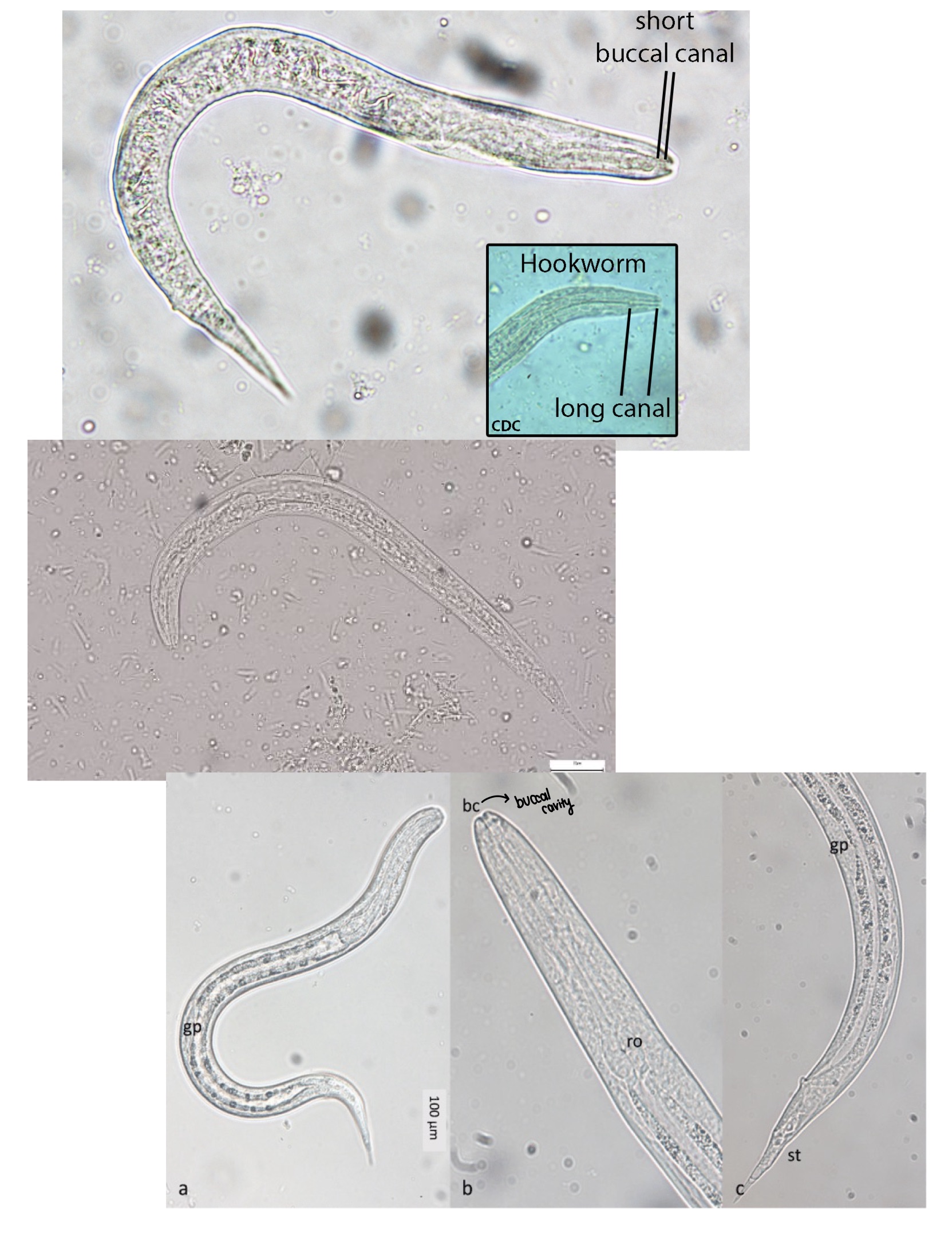 <p>Strongyloides stercoralis rhabditiform larvae </p>