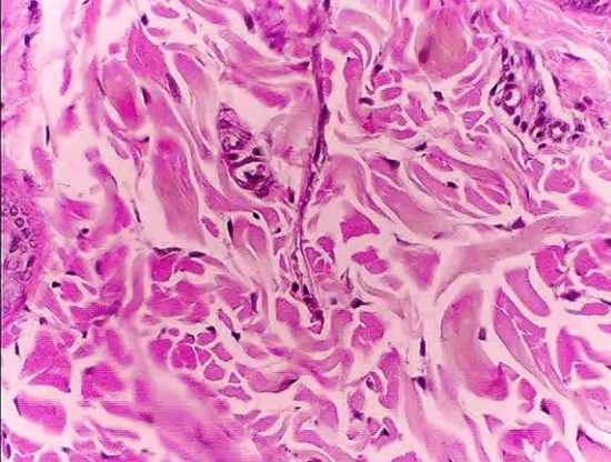 <p>dense irregular connective tissue</p>