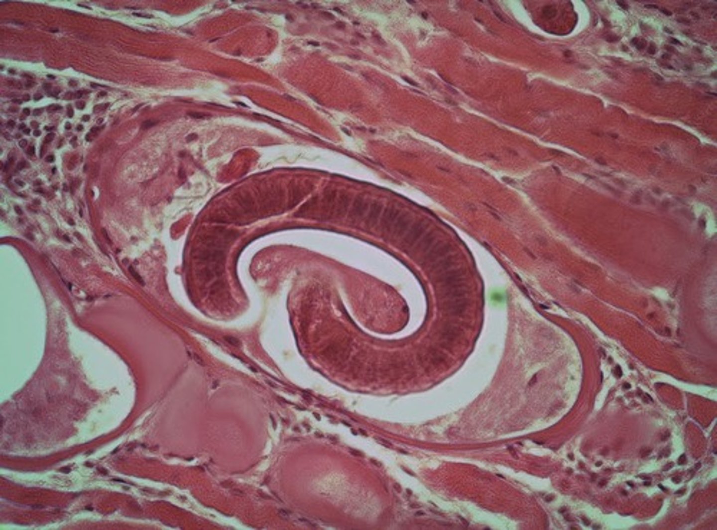 <p>nematoda</p>