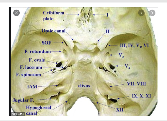 <p>CN III</p>
