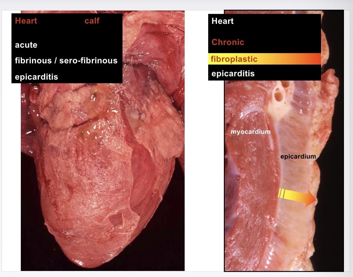 <p>Fibrin replaced by fibroblasts making fibrous CT</p>