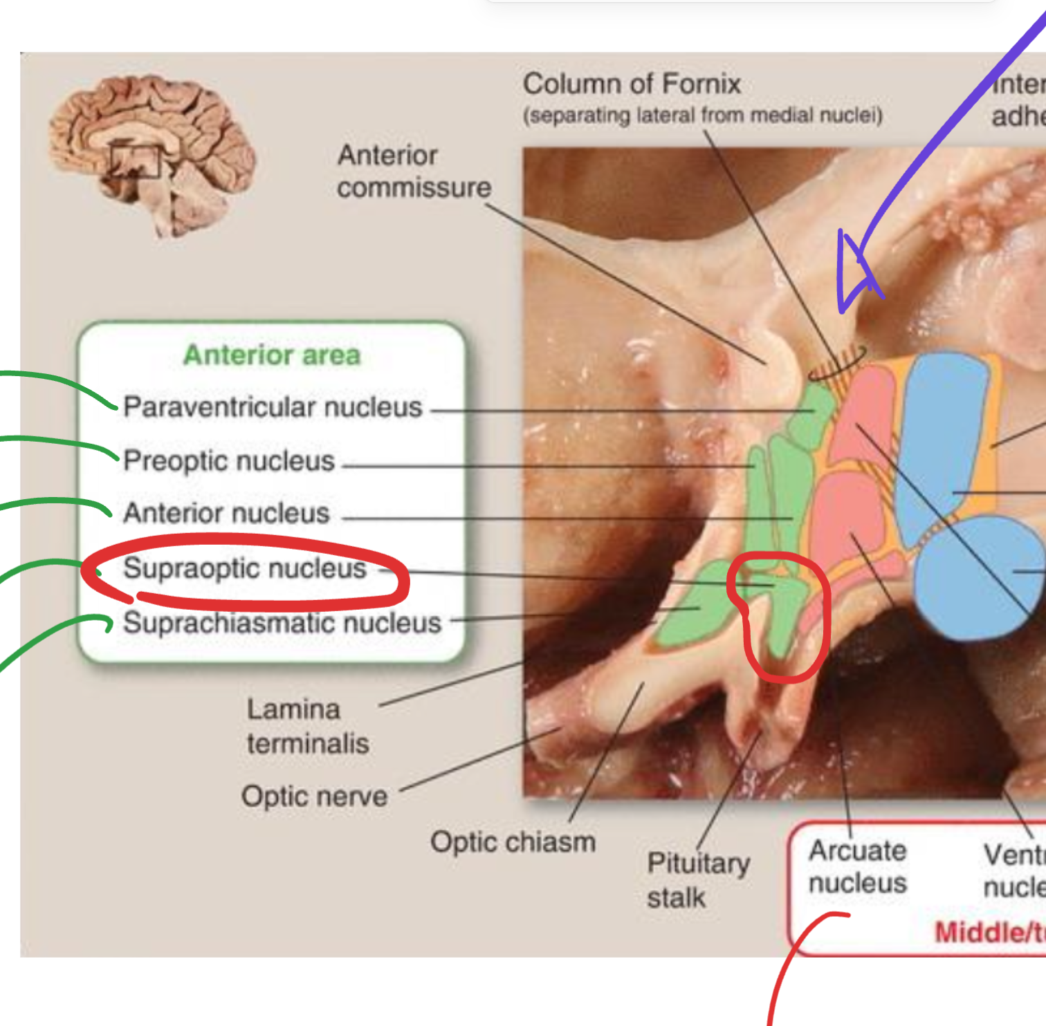 <p>Supraoptic nucleus</p>