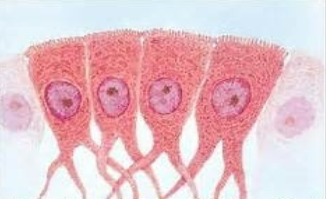 <p>which glial cell?</p><p><mark data-color="yellow" style="background-color: yellow; color: inherit">cubed shaped</mark> cells</p><p>line internal cavities of the <mark data-color="yellow" style="background-color: yellow; color: inherit">brain &amp; spinal cord (CNS)</mark></p><p><mark data-color="yellow" style="background-color: yellow; color: inherit">produce cerebrospinal fluid</mark> (CSF)</p><p>some have patches of cilia to help circulate CSF</p>