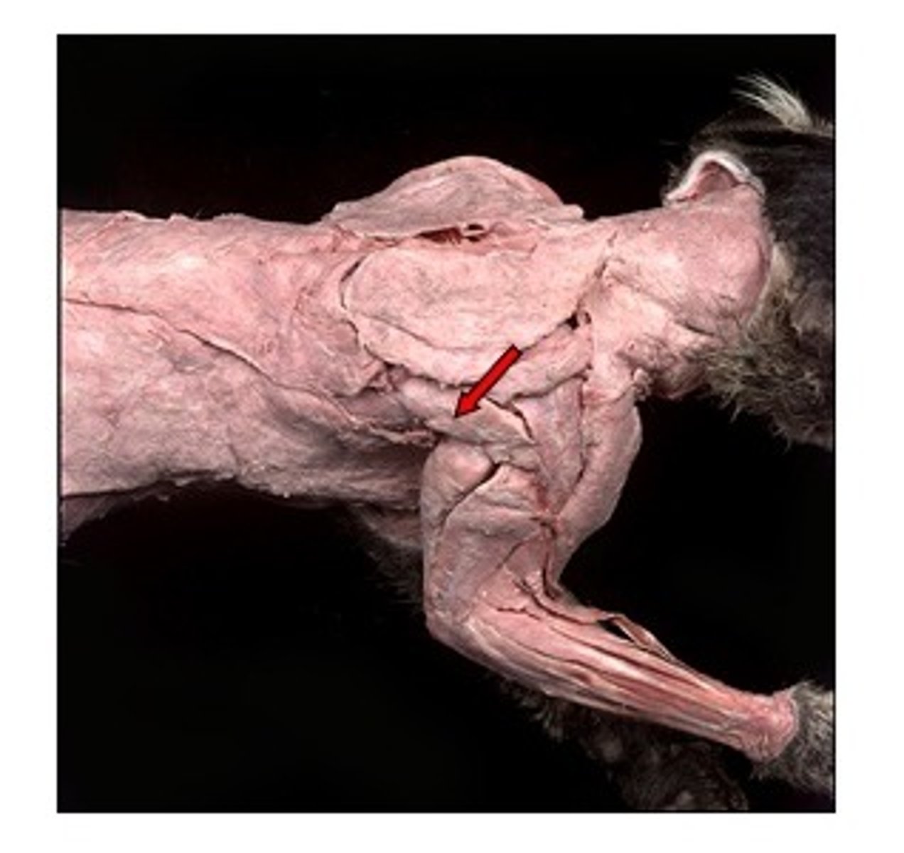 <p>name this muscle</p>