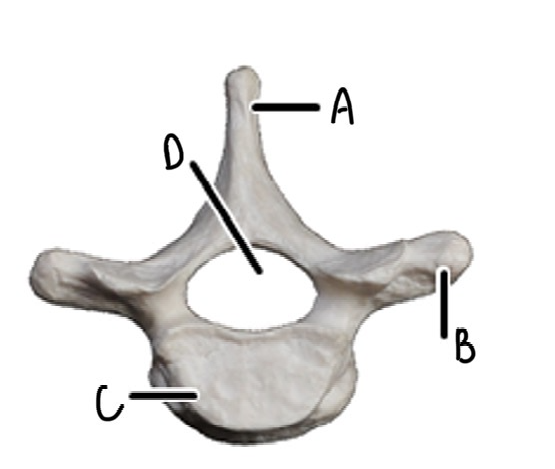 <p>What vertebrae is this and label it</p>