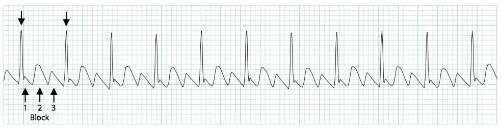 <p>What is this rhythm?</p>