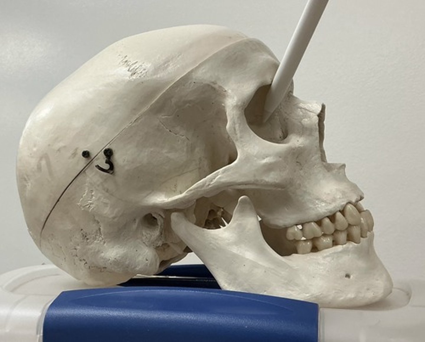 <p>What bone is this?</p>