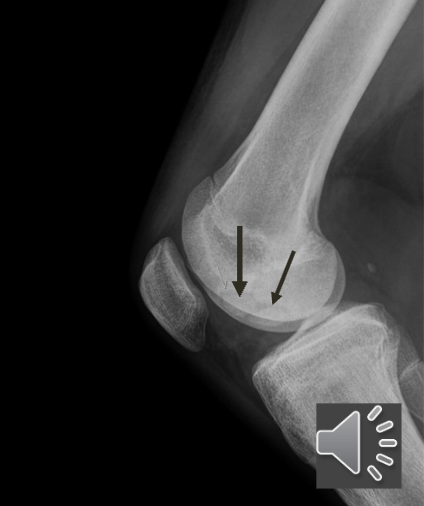 <p>Name this pathology</p>