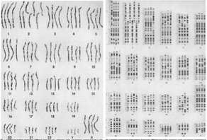 <p><span>→ Le chromosome 2 humain provient de la fusion de deux chromosomes de grands singes.</span></p><p><span>Cette constatation a pu être réalisé grâce à une génomique comparative basée sur l’observation des bandes G en prophase tardive sur différentes espèces.</span></p>