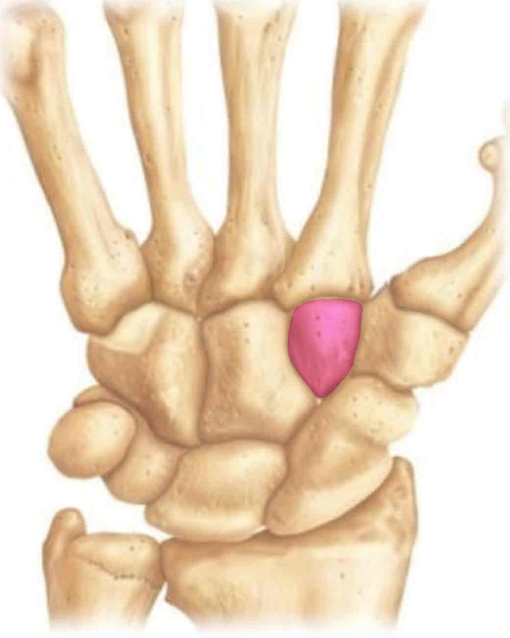 term image