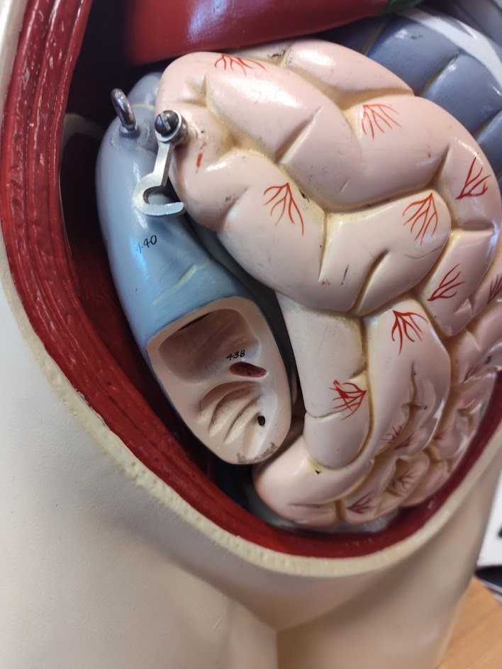 <p>ileocecal valve</p>