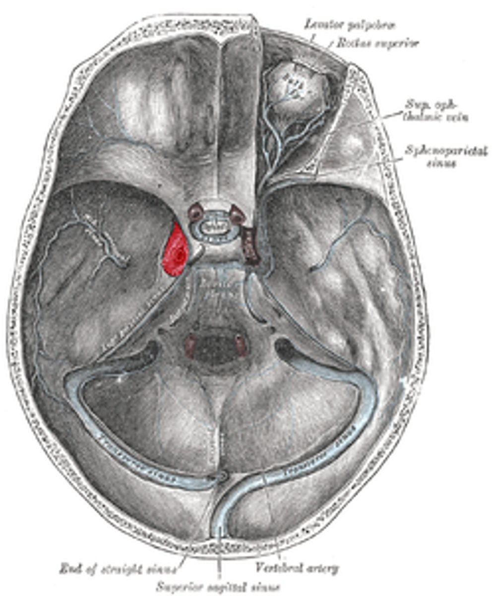 <p>Holds the internal carotid artery within it</p><p>Drains into the sigmoid sinus via 2 smaller sinuses</p>