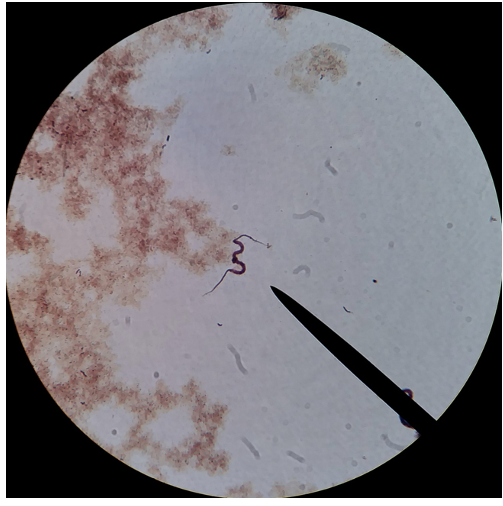 <p>What disease does this species cause?</p>