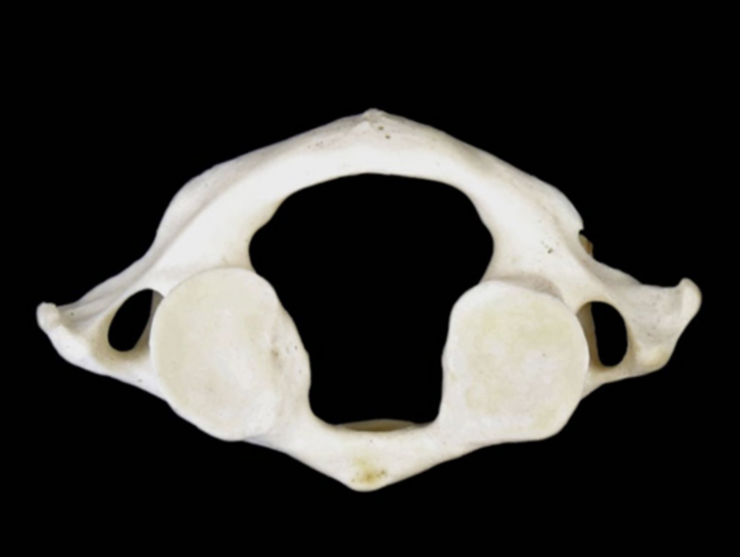 <p>Type of vertebrae</p>