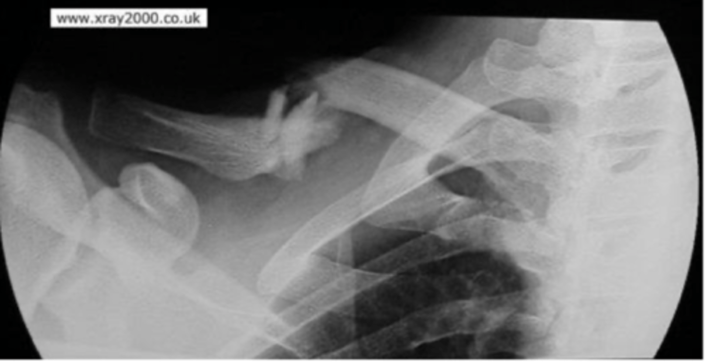 <p>What is the issue?</p>