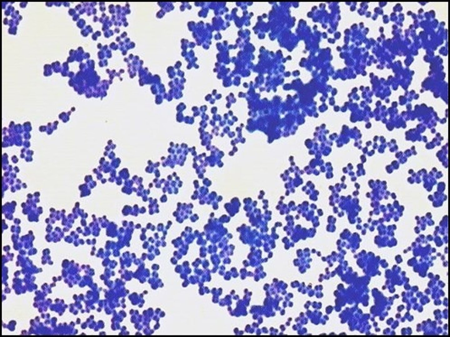 <p>There are both gram negative and gram positive cocci on the picture. This stain is a</p>