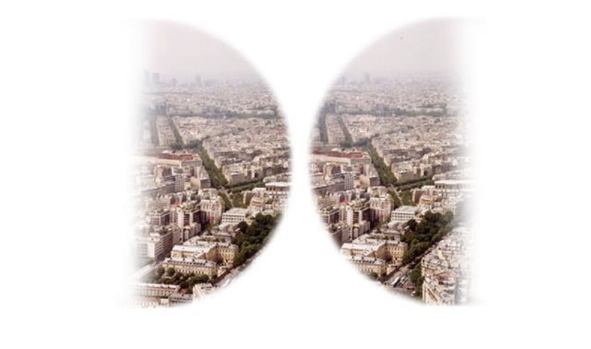 <p><span><span>Outer (temporal) halves (hemifields) of BOTH eyes</span></span></p><p><span><span>damage: Optic chiasm (often tumor)</span></span></p>