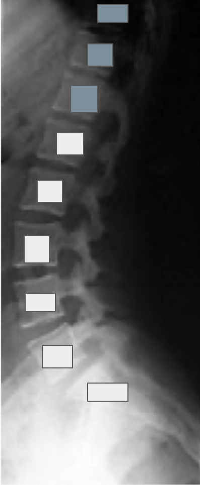 <p>What structures are referenced by the grey boxes?</p>