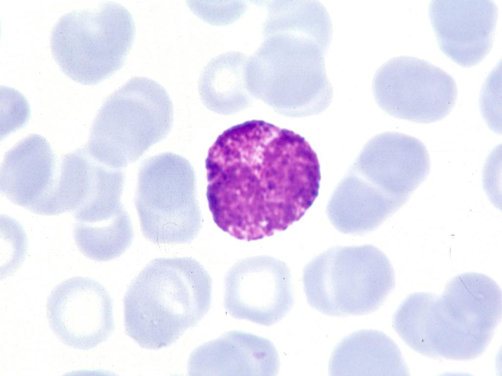 <p>which leukocyte is this?</p>