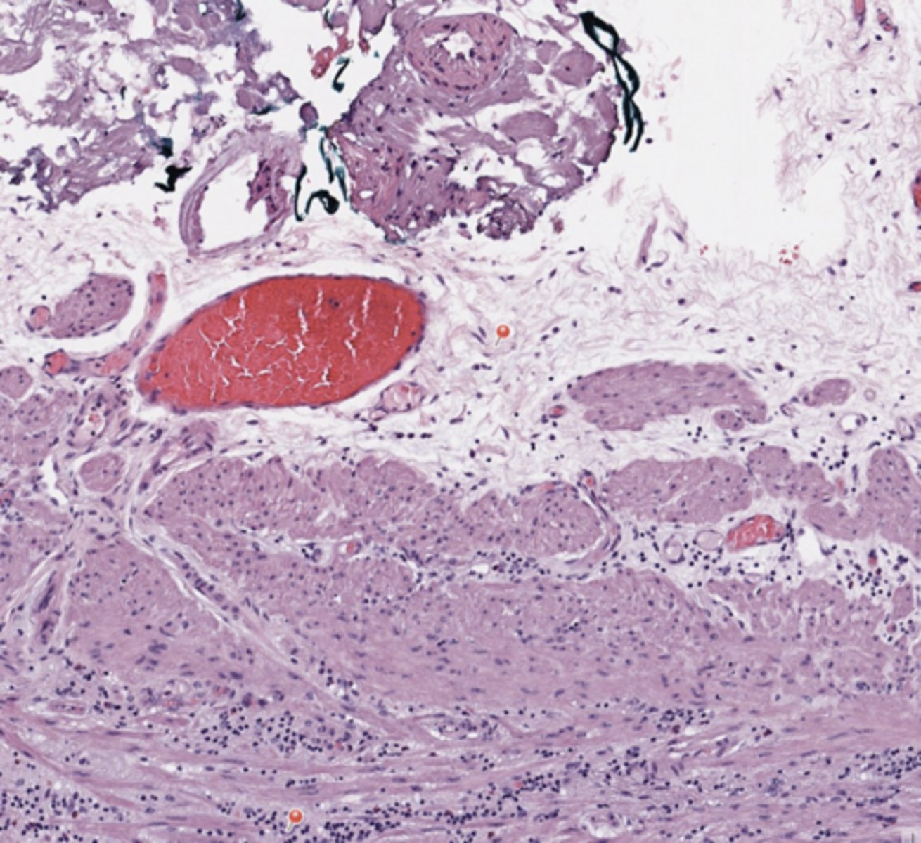 <p>Stomach</p>