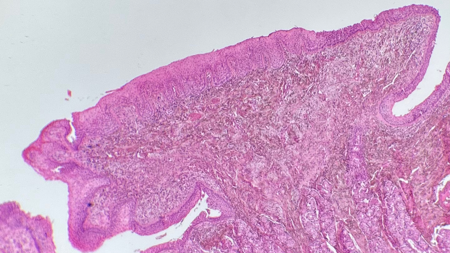 term image