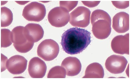 <ul><li><p>account for about 30 percent of all WBCs</p></li><li><p>participate in immunity</p></li><li><p>are white blood cells with large nucleus and small rim of cytoplasm</p></li><li><p>they play an important role in the </p><ul><li><p>lymphatic system </p></li><li><p>immune system.</p></li></ul></li></ul><p></p>