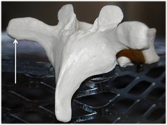 Name this specific part of the thoracic vertebra.