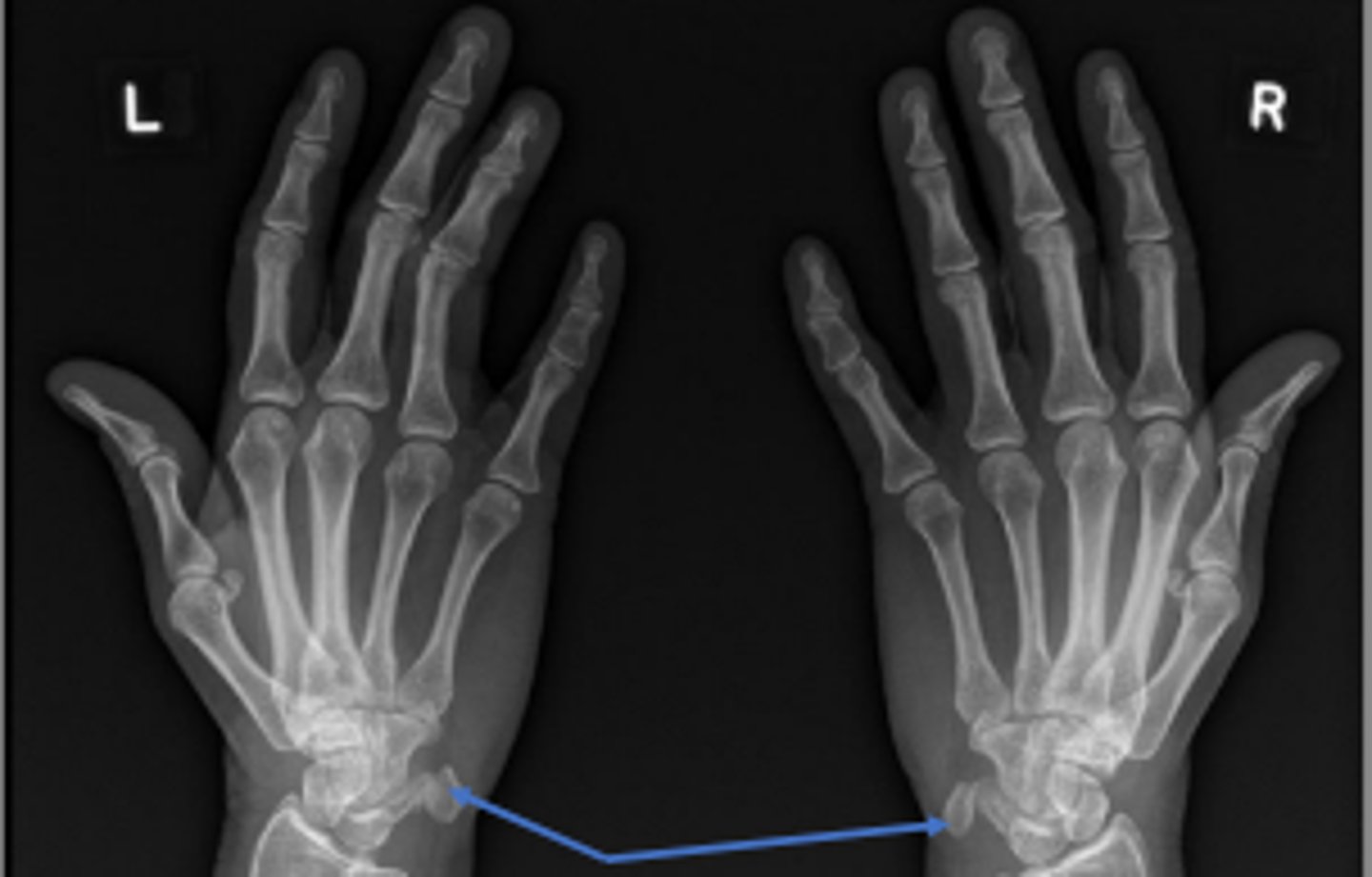 <p>What is the name of the radiographic view?</p>