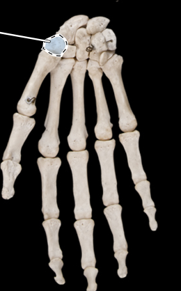 <p>Bones of the hand, anterior view, right side</p>
