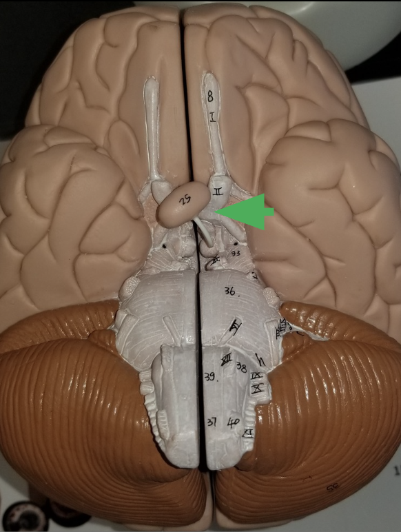 <p>what does the arrow indicate ?</p>