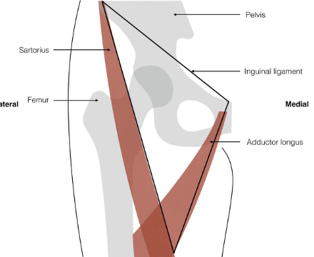 <p>SAIL: </p><p><span style="background-color: transparent;"><strong><span>Lateral border </span></strong><span>– sartorius m.</span></span></p><p><span style="background-color: transparent;"><strong><span>Medial border </span></strong><span>– adductor longus m.</span></span></p><p><span style="background-color: transparent;"><strong><span>Superior border </span></strong><span>– inguinal ligament</span></span></p>