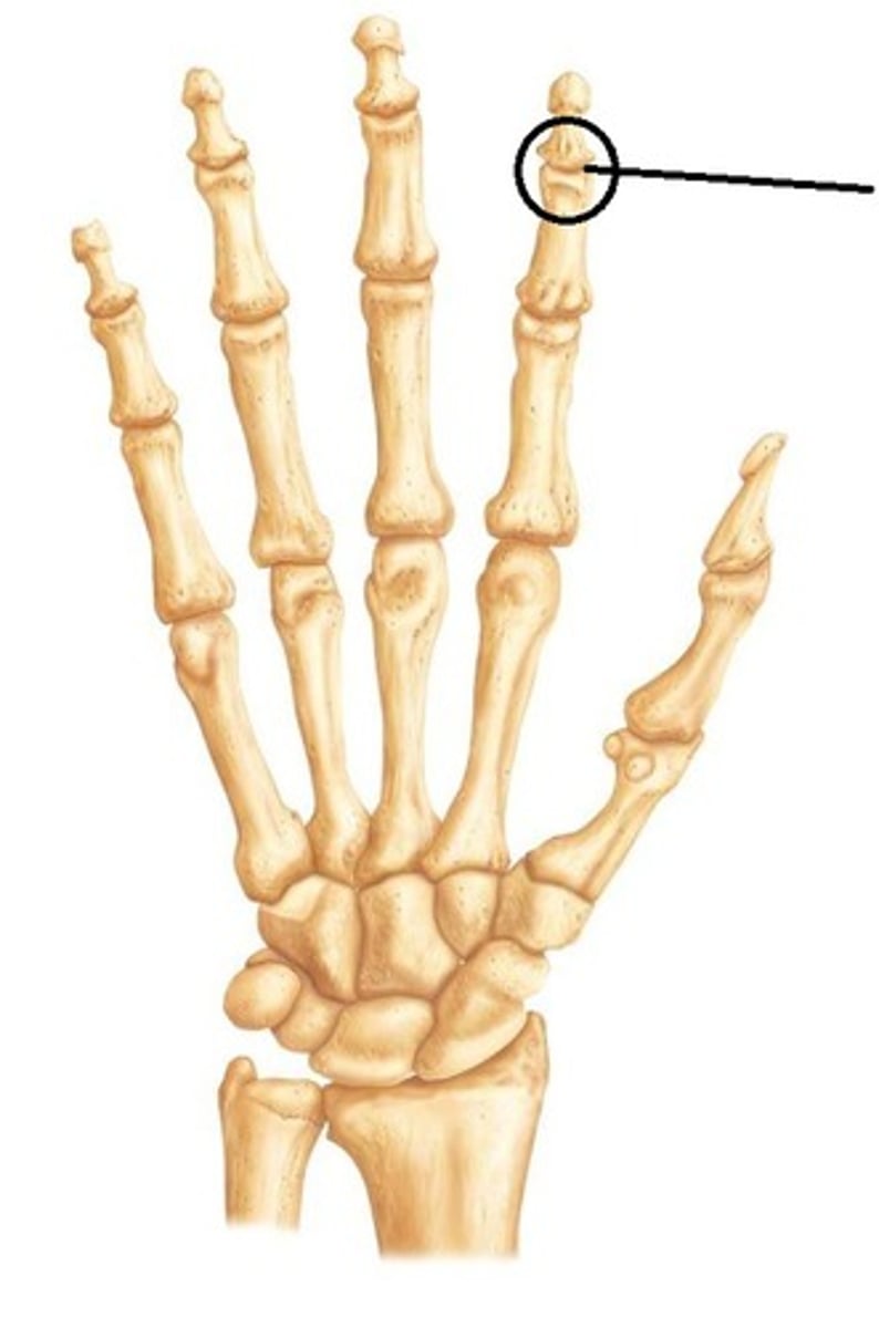 <p>What joint is this?</p>