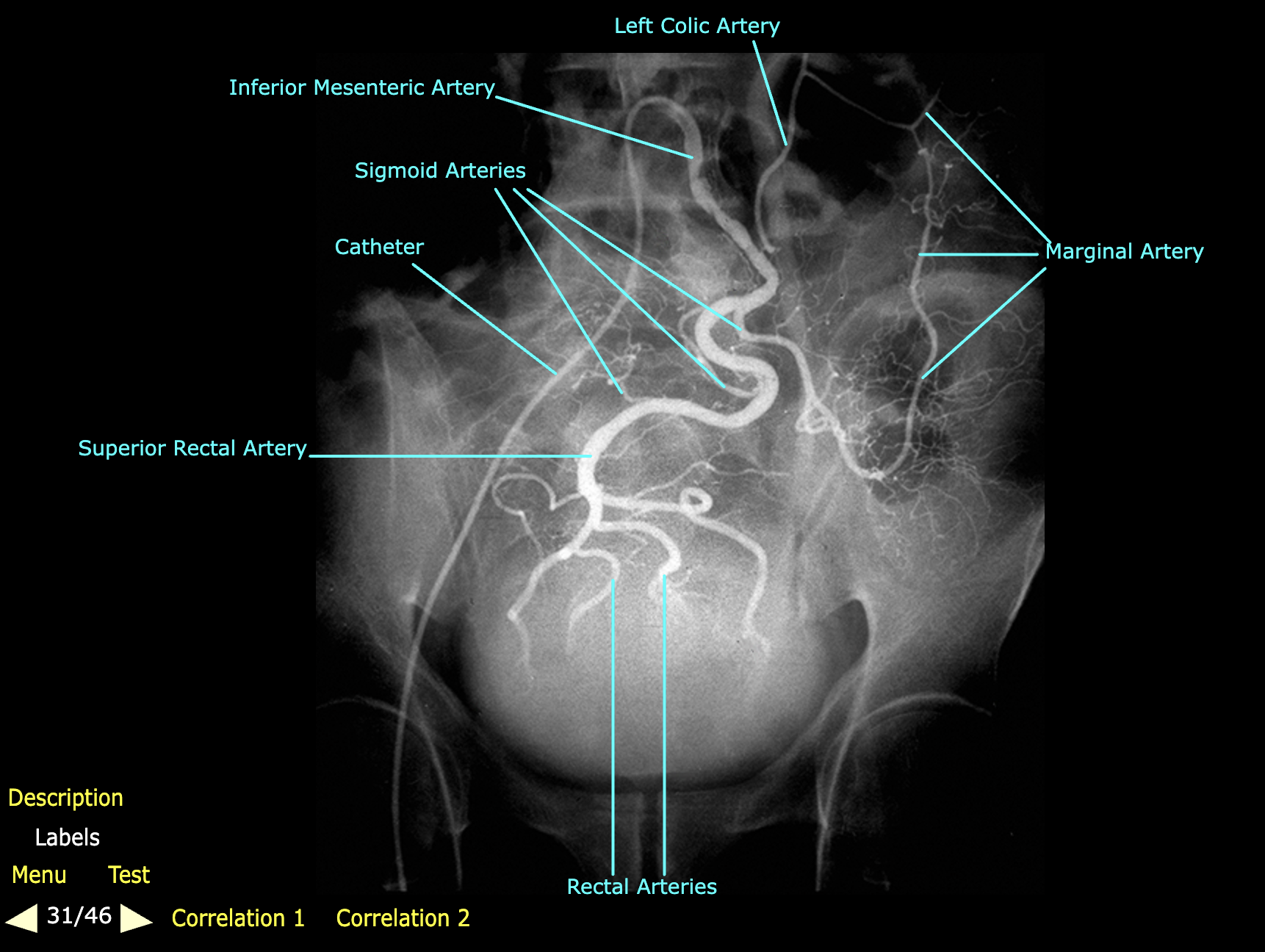 knowt flashcard image