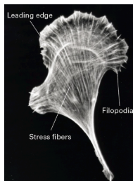 <p>contractive structures (aka filopodia)</p>