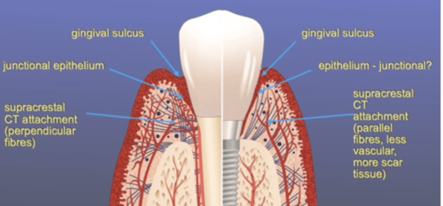 <p>Fibres are parallel &amp; perpendicular so BL can be slower than in implants (bacteria can penetrate implant sulcus much easier bc it goes straight down)</p><p>implant - epithelial tissue attachment (less robust than CT)</p>