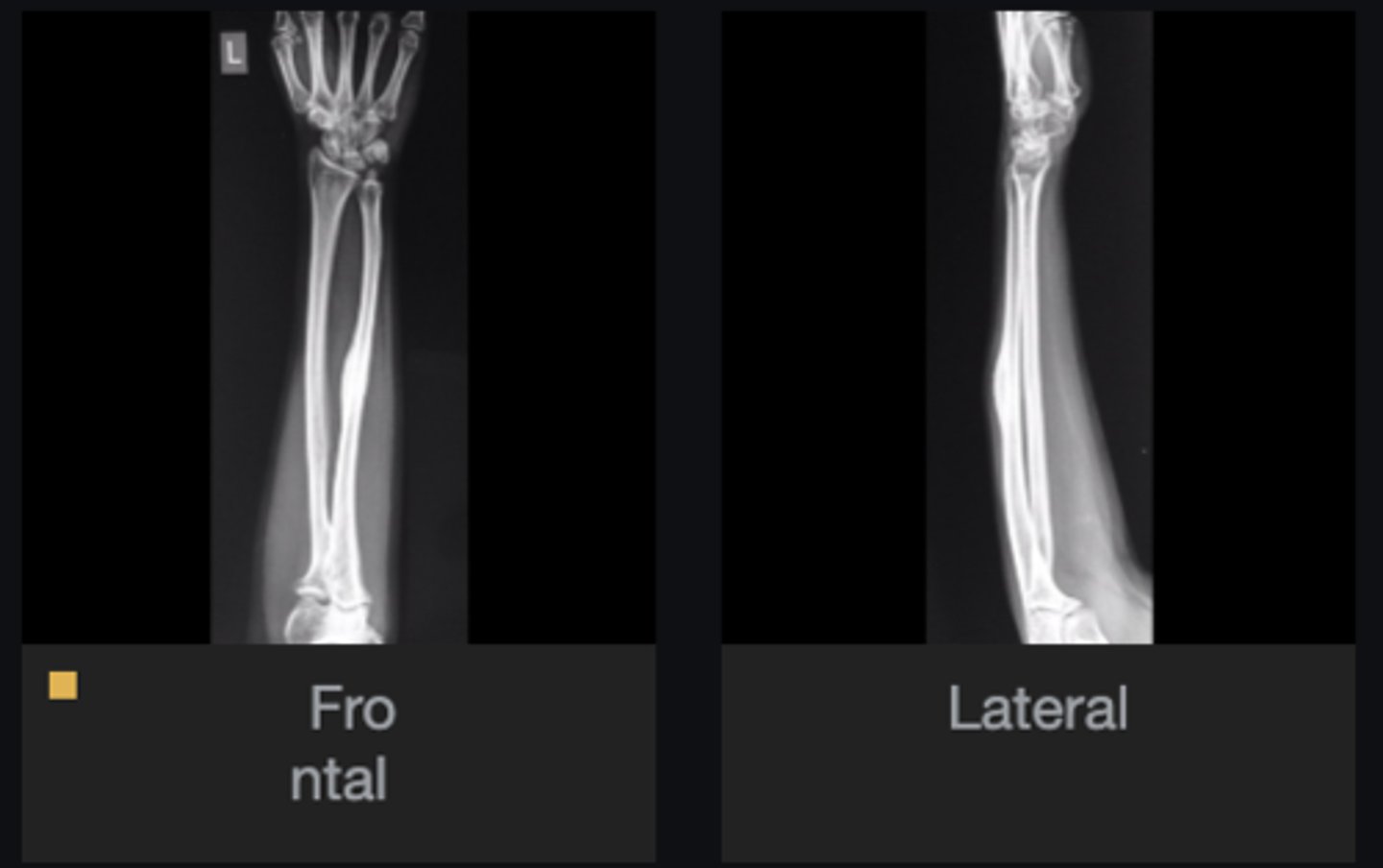 <p>Concerns/complications?</p>