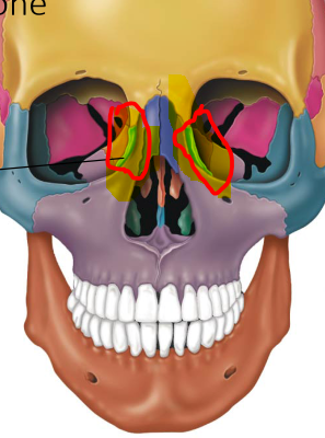 <p>-smallest bone of face -2 fingers like bones in inner orbit -Has lacrimal fossa that houses lacrimal sac</p>