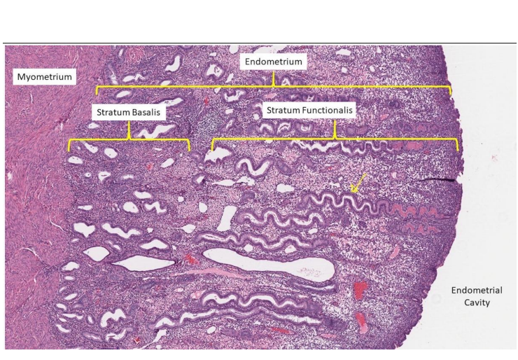<p>ENDOMETRIUM:</p><p>- Stratum functionalis (functional layer):</p><p>- uterine/spiral glands</p><p>- venous sinusoids, uterine capillaries</p><p>- responsive to ovarian hormones</p><p>Also has a Stratum Basalis (basal layer): origin of uterine/spiral glands, unresponsive to ovarian hormones</p><p>MYOMETRIUM:</p><p>- middle smooth muscular layer, contractions/growth/stretch during childbirth</p><p>PERIMETRIUM:</p><p>- outer serous layer (derived from peritoneum)</p><p></p><p>- spiral glands are the weird snaky looking ones</p>