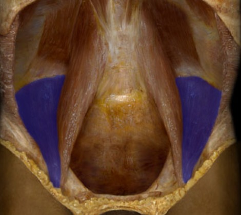 <p>sits on ilium, lateral</p>