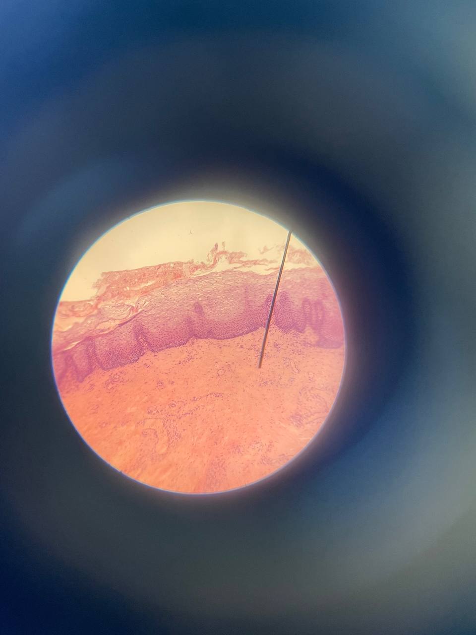 term image