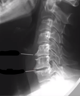 <p>identify radiogaphic findings</p>
