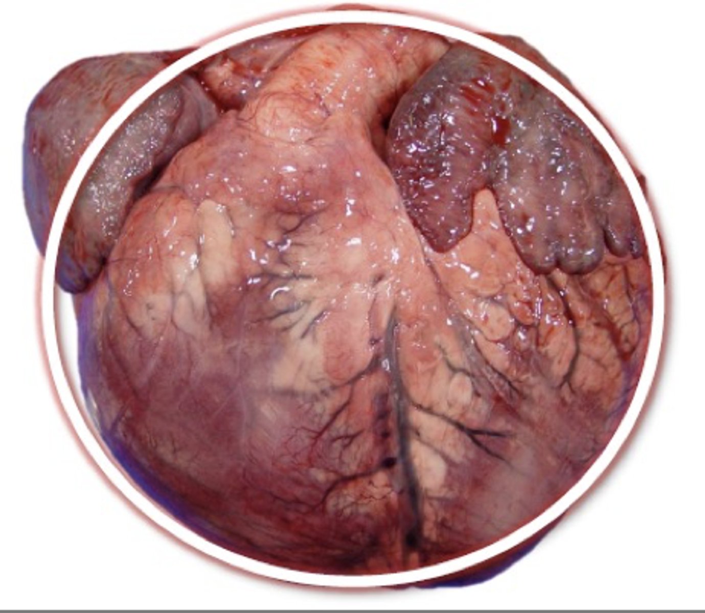 <p>If a patient has a heart that is gross in appearance as shown in the picture, what are some underlying causes? (Multiple answers apply)</p><p>A. Mitral valve disease</p><p>B. DCM</p><p>C. Aortic stenosis</p><p>D. Pulmonary hypertension</p><p>E. HCM</p><p>F. VSD</p><p>G. Pulmonic stenosis</p>