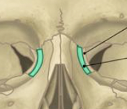 <ul><li><p>almost completely hidden</p></li><li><p>small portion of the lateral nasal wall</p></li></ul><p></p>