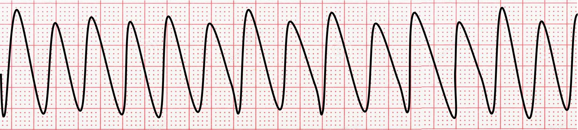 <p>What rhythm is this called?</p>